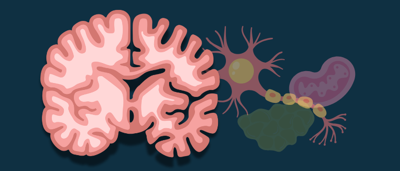 Alzheimer's CNN Classification